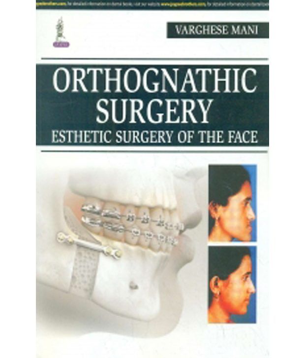 Orthognathic Surgery Esthetic Surgery Of The Face Buy Orthognathic