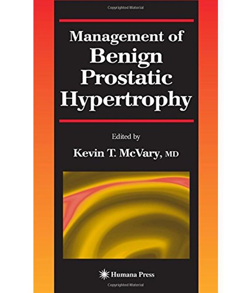 Buy Benign Prostatic Hyperplasia Treatment Online Management of Benign Prostatic Hypertrophy: Buy Management of Benign
