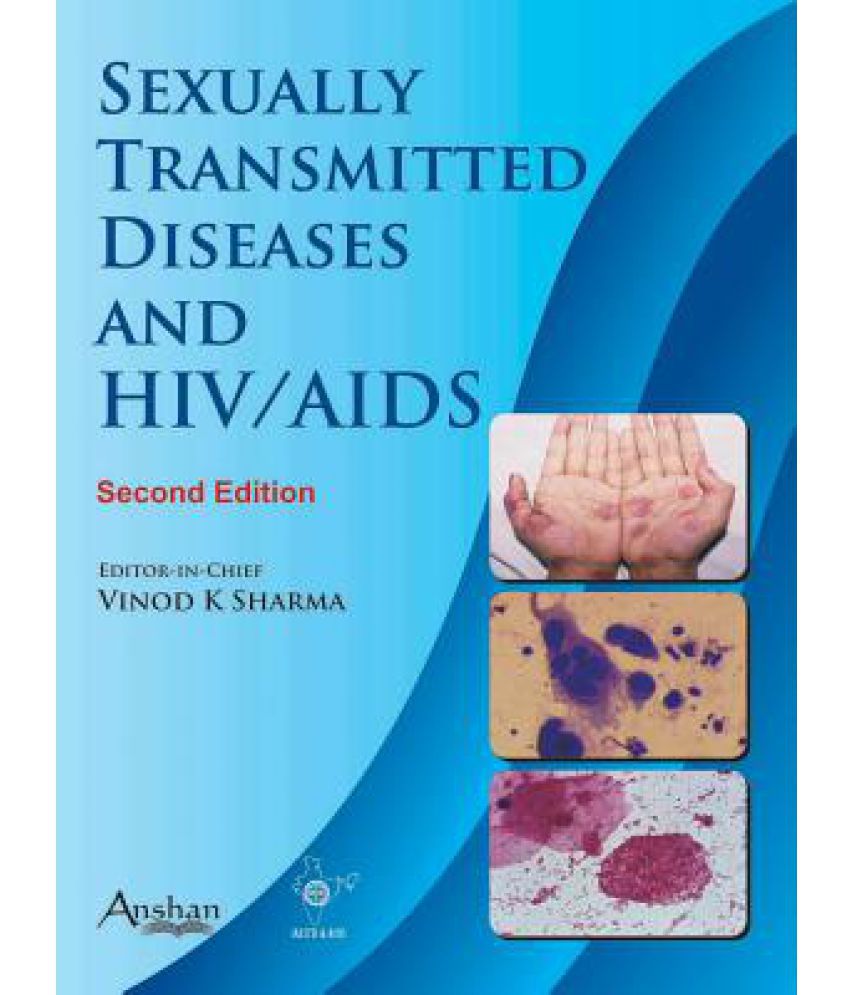 Sexually Transmitted Diseases And Hiv Aids E Buy Sexually