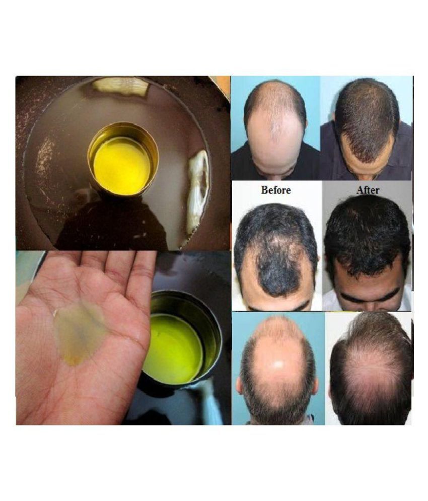 kesh Regrowth ayurvedic Hair Oil 100 ml Buy kesh Regrowth ayurvedic