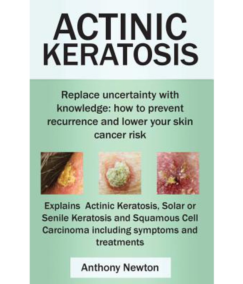 Actinic Keratosis. Replace the Fear and Uncertainty with Knowledge: How ...