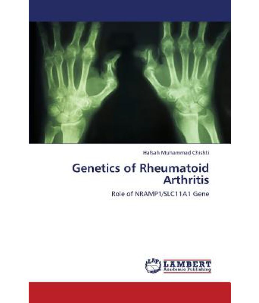 of Rheumatoid Arthritis Buy of Rheumatoid Arthritis