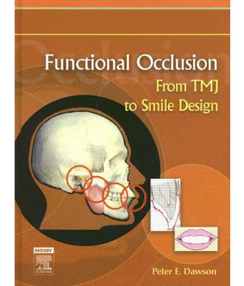 Functional Occlusion From Tmj to Smile Design Buy Functional