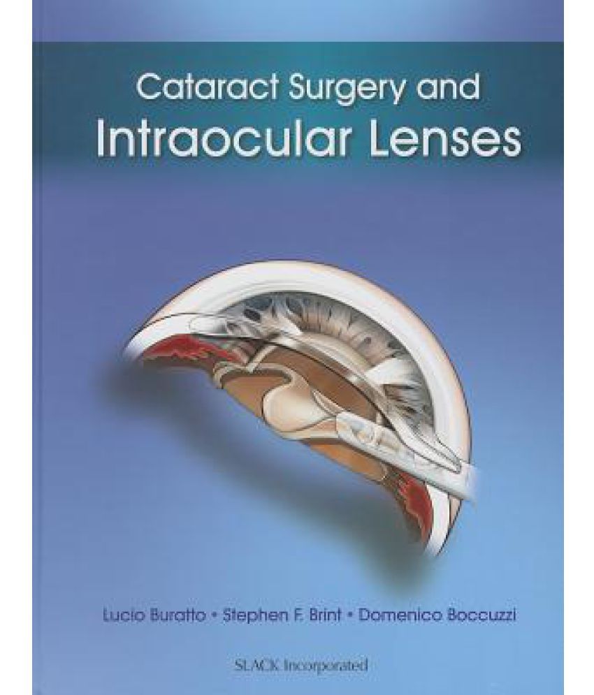 Cataract Surgery and Intraocular Lenses Buy Cataract Surgery and