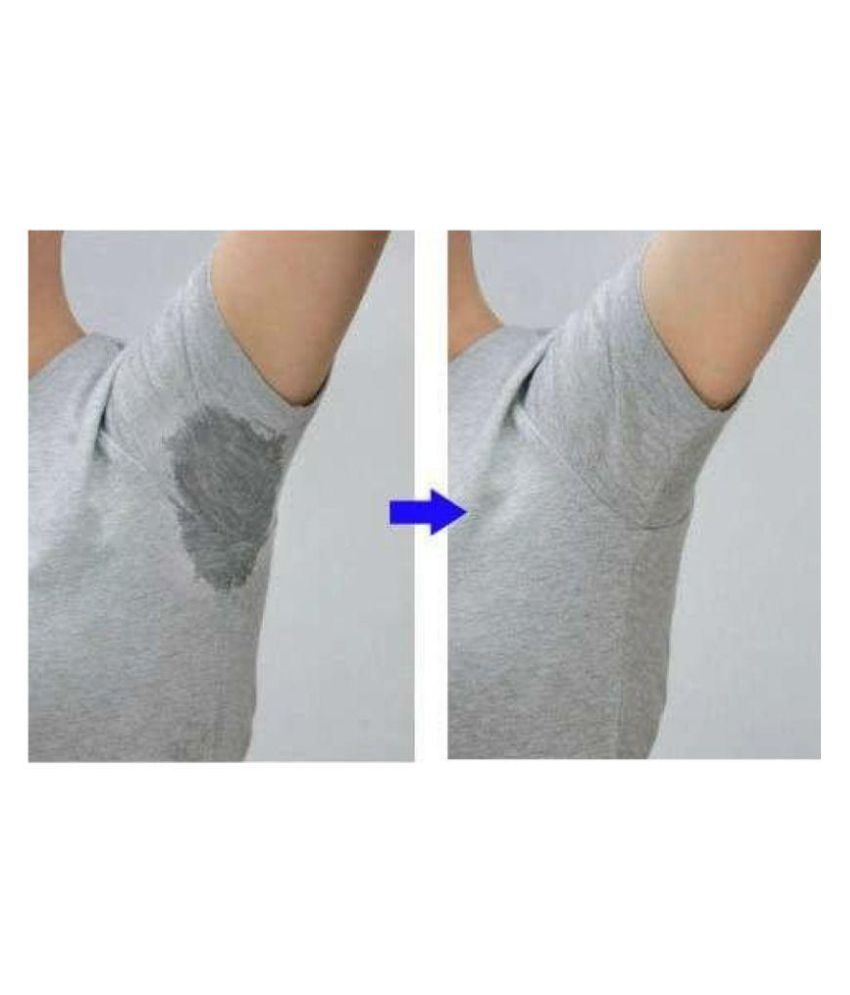 underarm sweat treatment