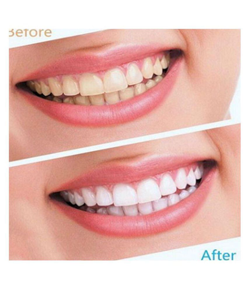 DIGITALSHOPPY Teeth Whitening Strips 50 gm: Buy ...