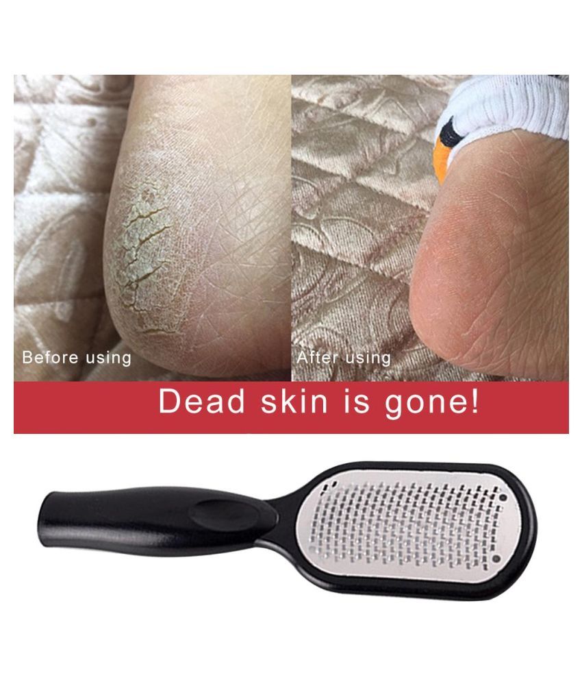 dead skin on feet removal tool