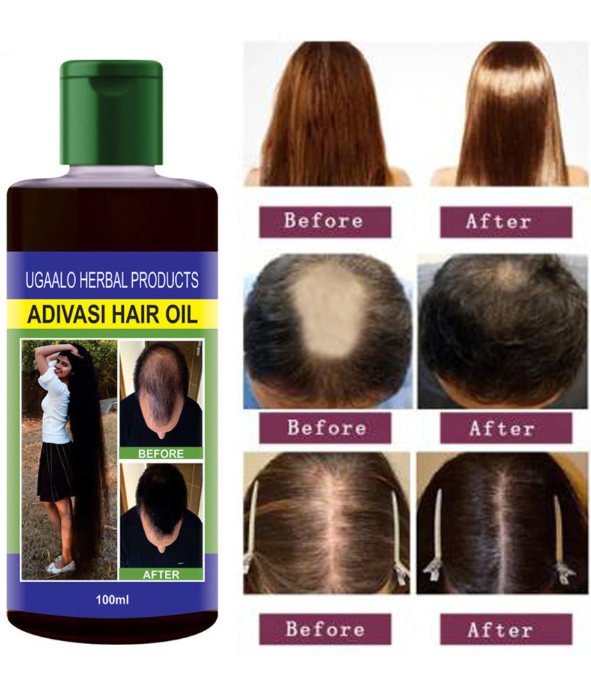     			Ugaalo - Hair Growth Amla Oil 100 ml ( Pack of 1 )