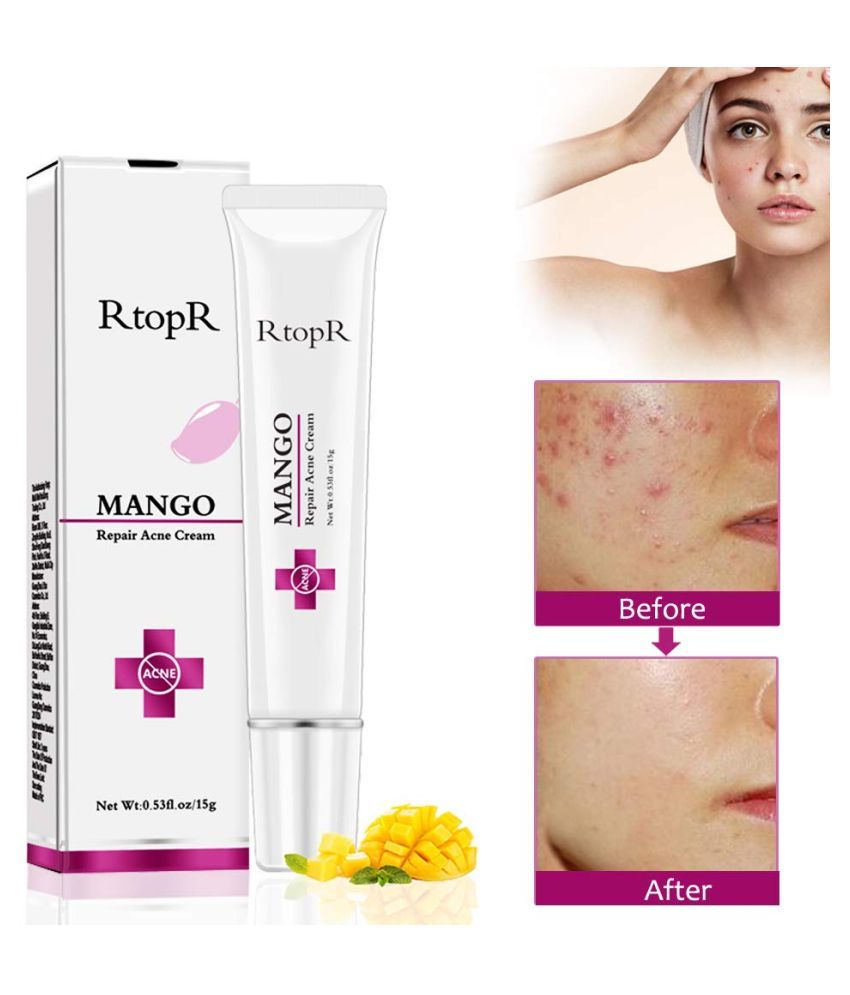 R top R Mango Blackhead Removal Day Cream 40 gm Buy R top R Mango Blackhead Removal Day Cream