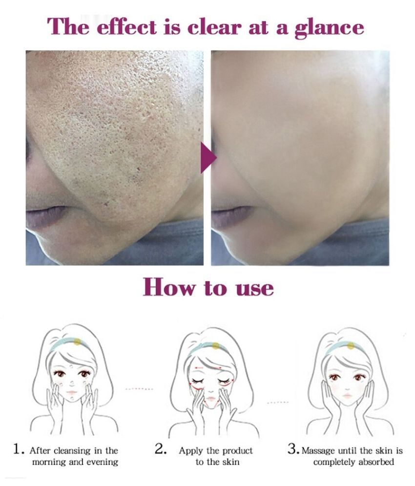 R top R Mango Blackhead Removal Day Cream 40 gm Buy R top R Mango