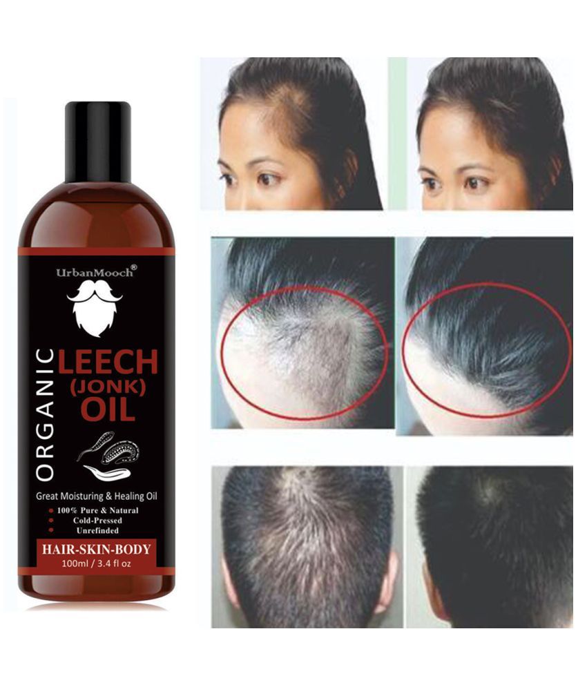 Buy UrbanMooch Natural Jonk Leech Oil For Hair Growth & Dandruff Oil- 100  mL Online at Best Price in India - Snapdeal