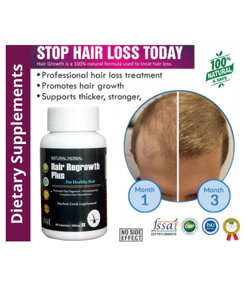 Natura Herbal Hair Regrowth+ Anti HairFall/Dandruff & HairGrowth Capsule 60 no.s