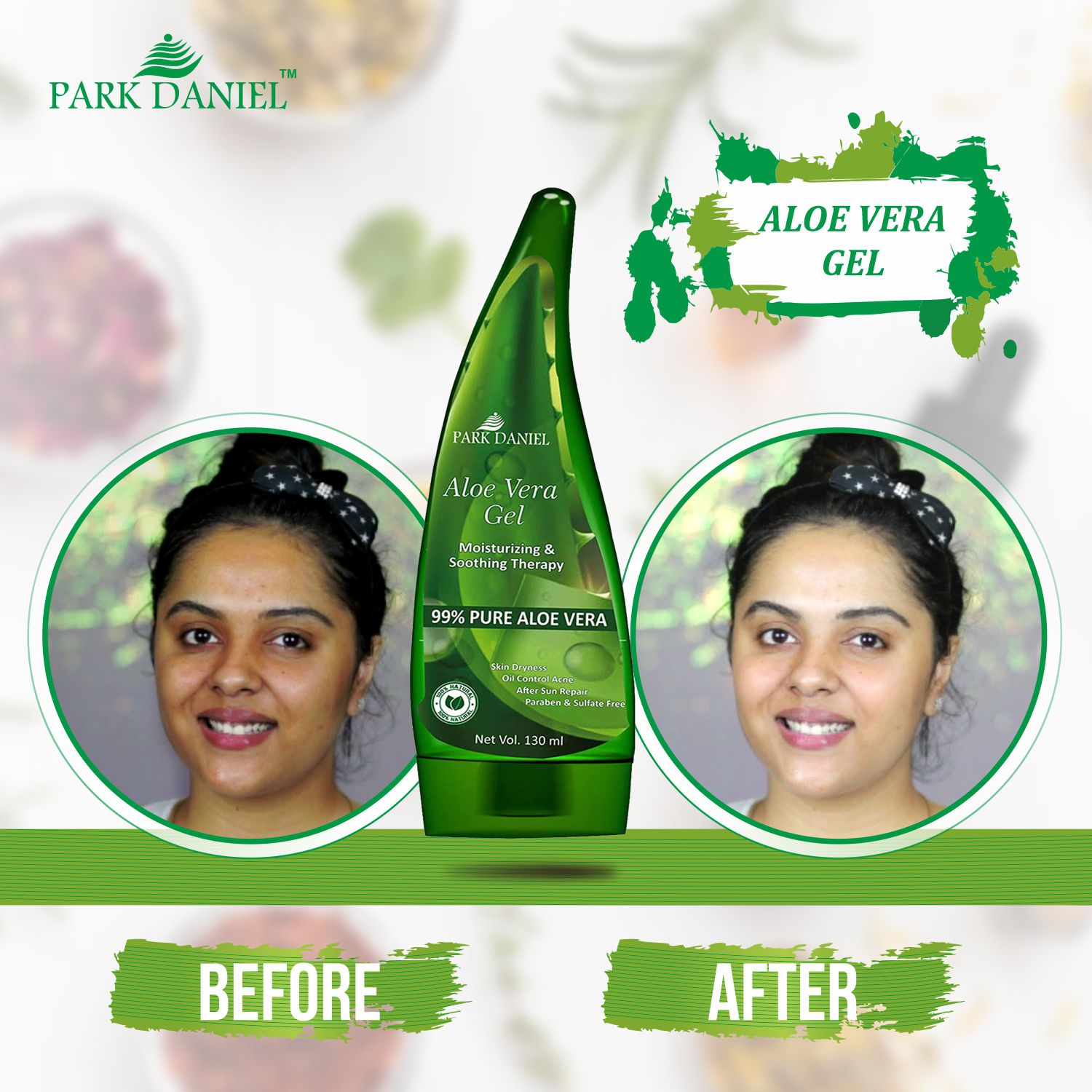     			Park Daniel Premium 99% Pure Aloe Vera Gel Face Moisturizer & Lotion 130 ml