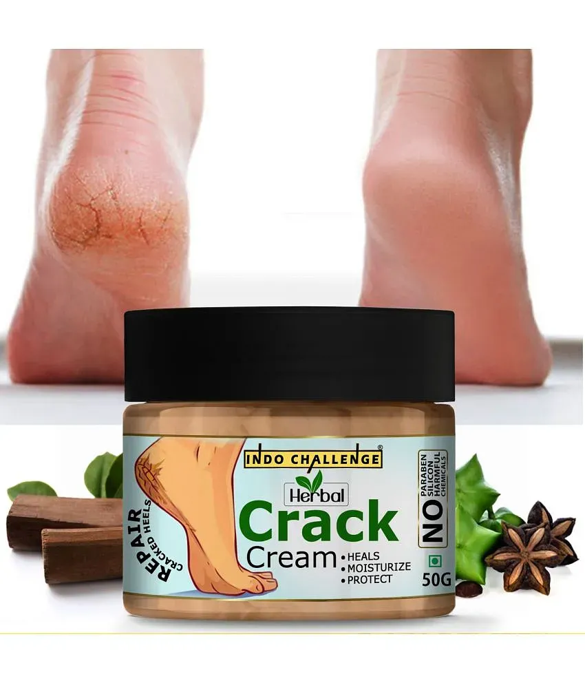 Smartdrops Chapped Hand And Foot Cream Crack Peeling Repair Anti Dry Skin Remove  Dead Skin Foot Moisturizing (50gm) (For Women and men) Pack of 4