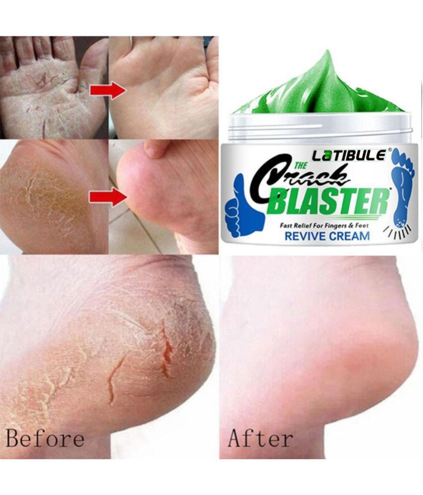 QWERA Crack Heel Repair I Foot Care Cream I Foot Odour Deodorizer Cream 50 mL