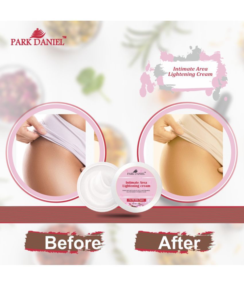     			Park Daniel Intimate Area Lightening Cream For All Skin Types Pack of 1 of 100 Grams