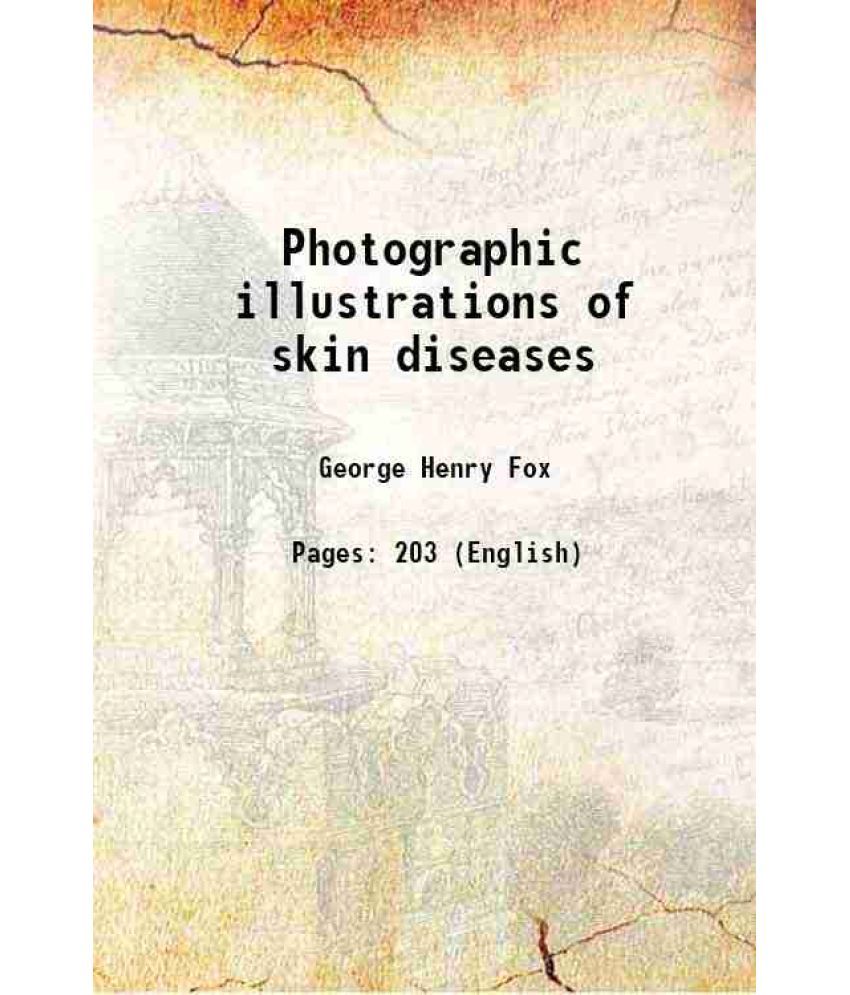     			Photographic illustrations of skin diseases 1880