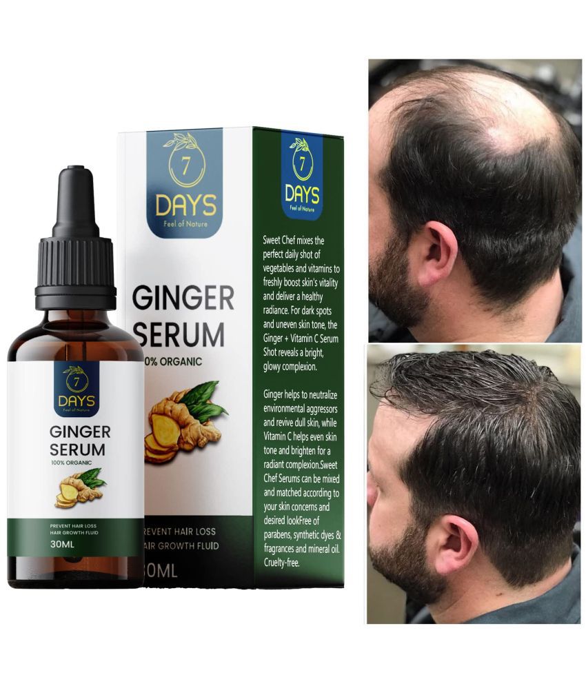     			7 days - Hair Growth Ginger Onion Oil 30 ml ( Pack of 1 )