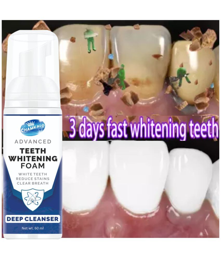 UPASTHIT DEEP CLEANSER ADVANCED TEETH WHITENING FOAM Denture Oral Kit