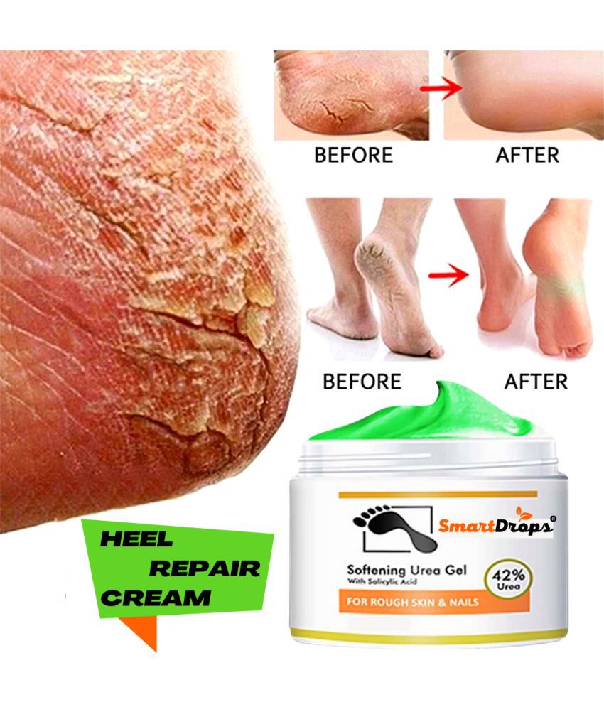    			Smartdrops Chapped Hand And Foot Cream Crack Peeling Repair Anti Dry Skin Remove Dead Skin Foot Moisturizing (50gm) Pack of 1