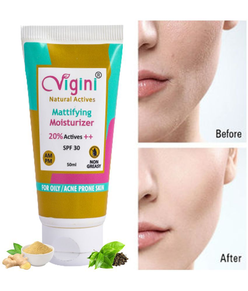 Vigini Anti Acne Pimples Scars Removes Mattifying Cream for oil Control & Soft Skin Pores with SPF30 , Ginger Ext, Hyaluronic Acid, Vitamin E-50ml