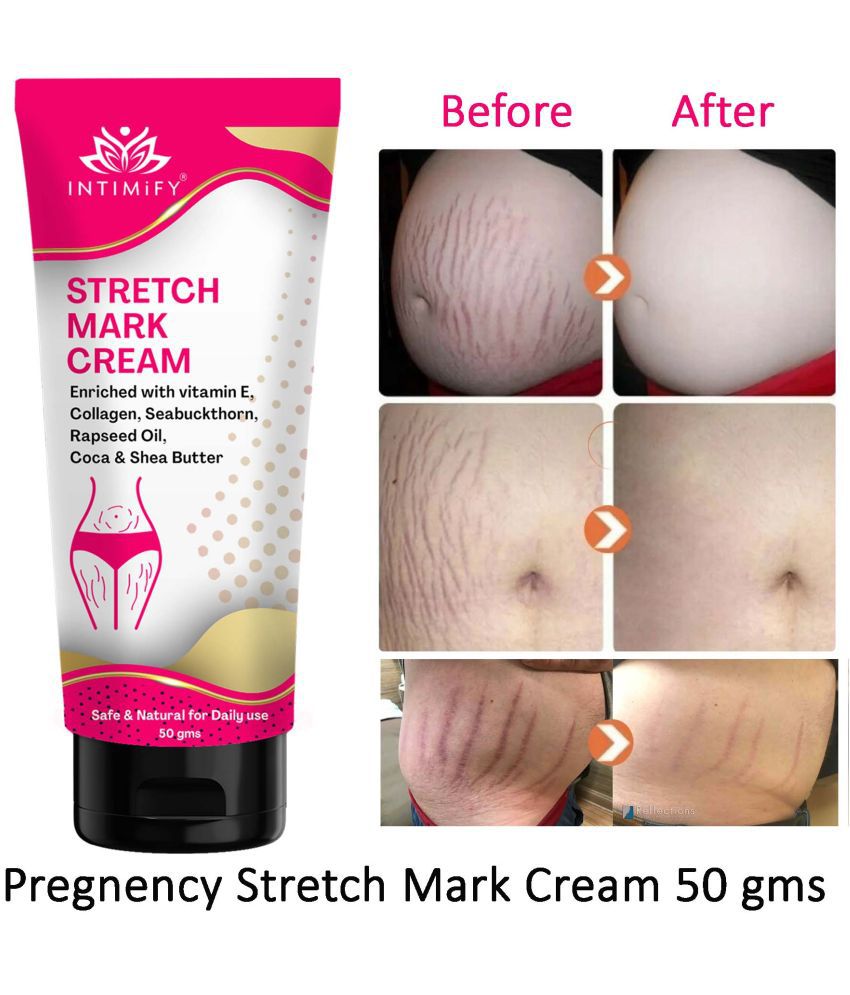     			Intimify Stretch Mark Cream, Scar Cream, Stretch Mark Remover Shaping & Firming Cream 50 g