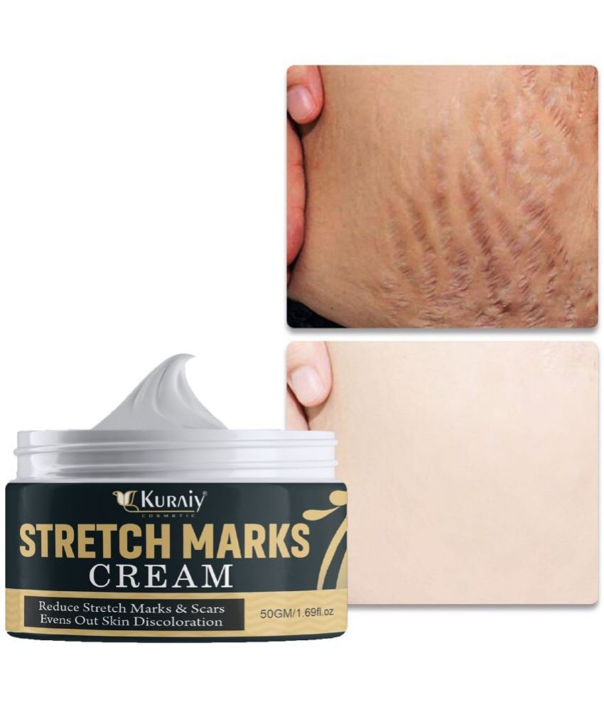     			KURAIY Remove Pregnancy Mark Body Cream Treatment Scars Acne Stretch Marks Cream Maternity Repair