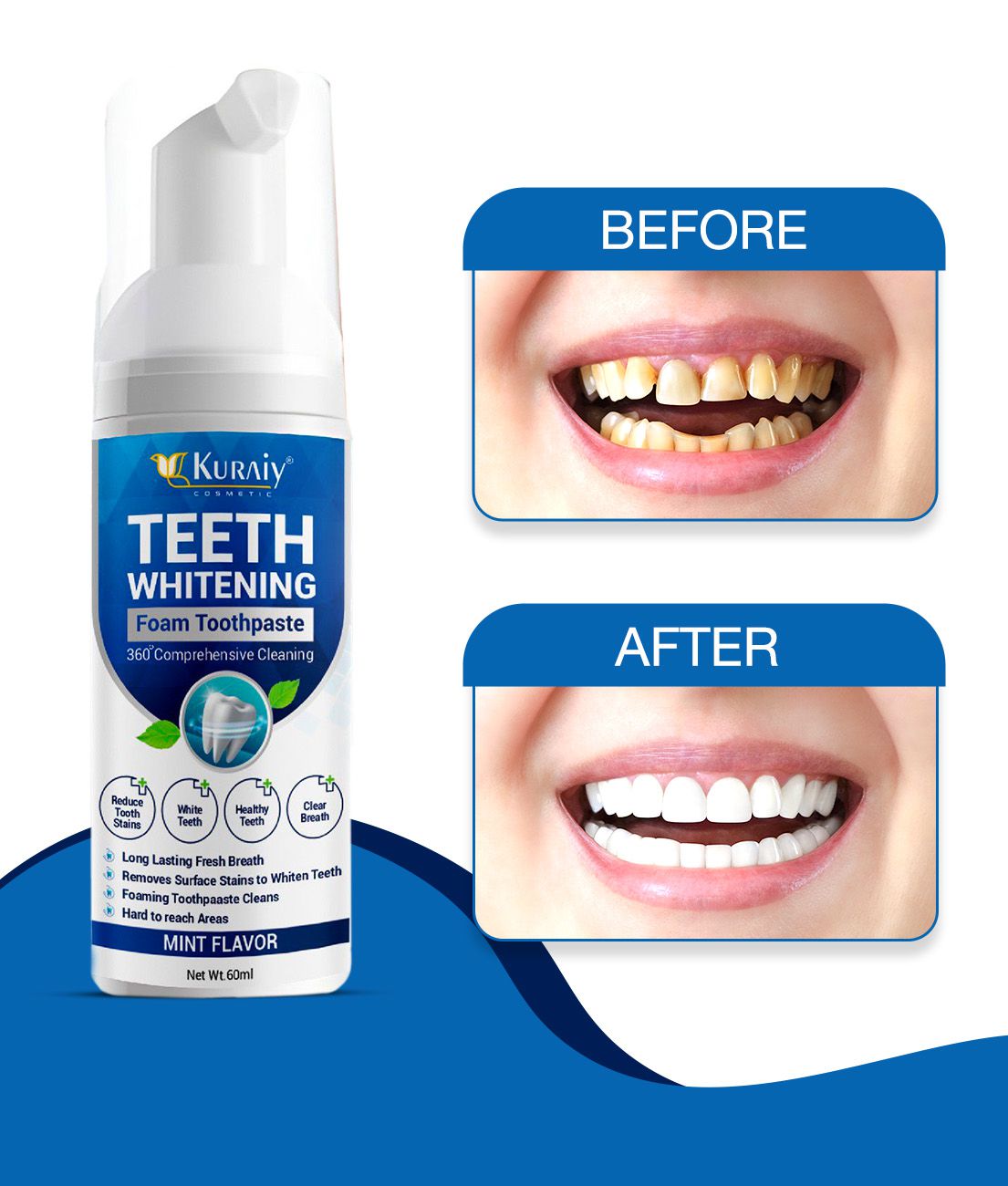     			Kuraiy New Teeth Whitening Powder Oral Hygiene Cleaning Remove Bleaching Hygiene Tooth Care