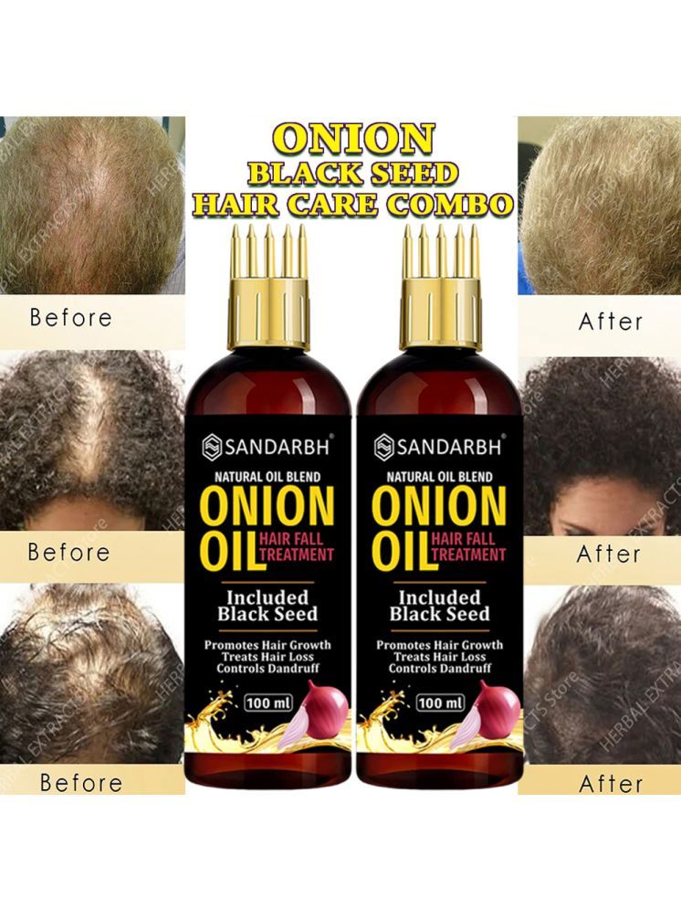     			Sandarbh Anti Dandruff Onion Oil 100 ml ( Pack of 2 )