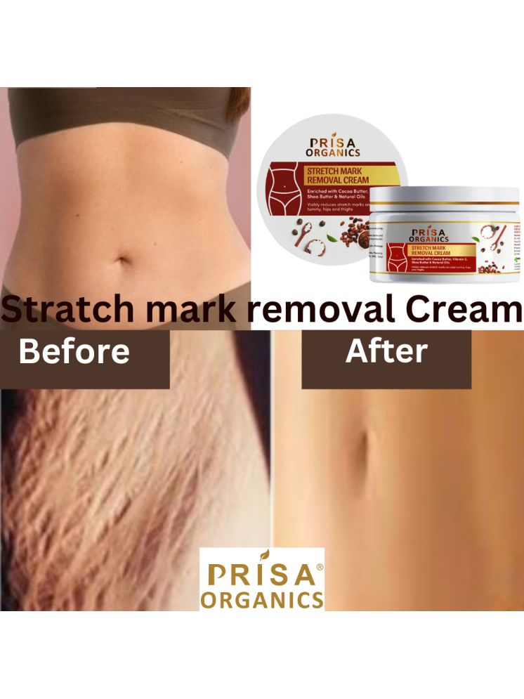     			PRISA ORGANICS Pigmentation Cream Floral ( 50 g )