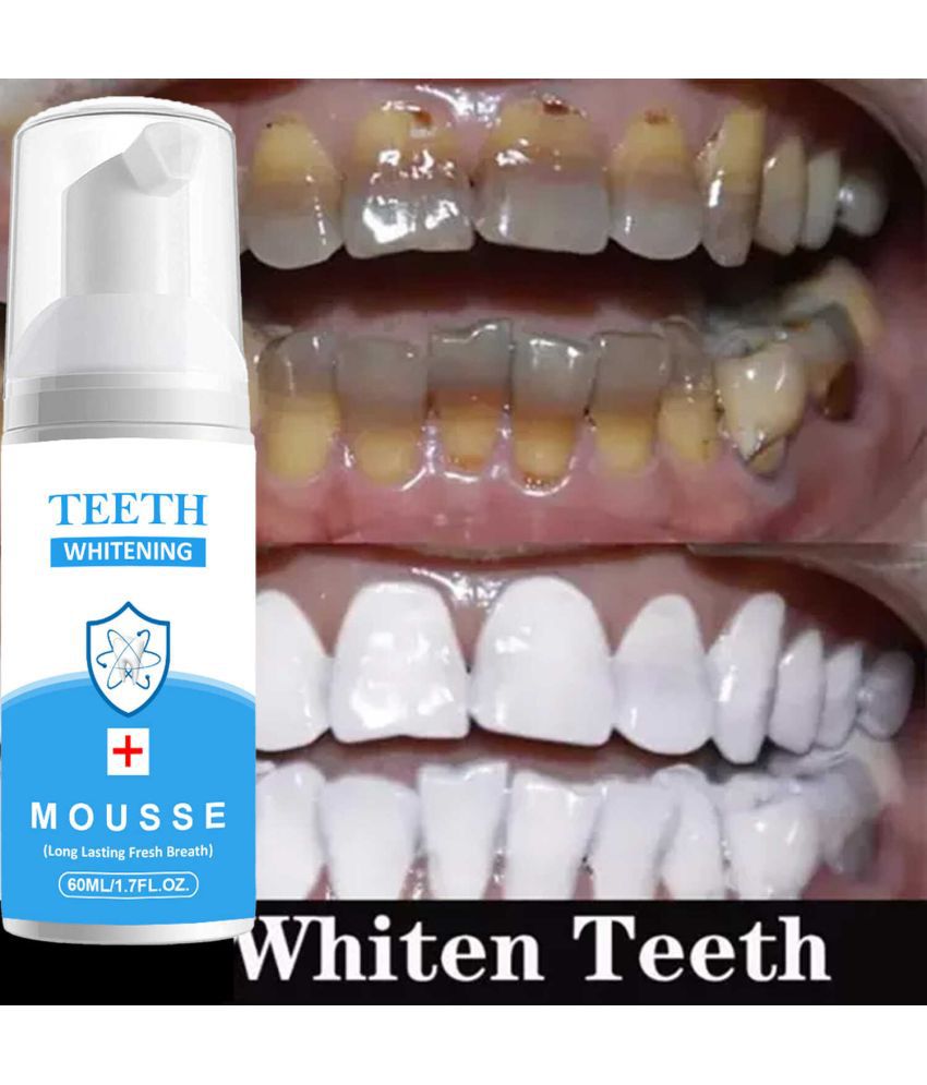     			Latibule Teeth Whitening Foam For Long Lasting Fresh Breath, 60ml, Pack of 1