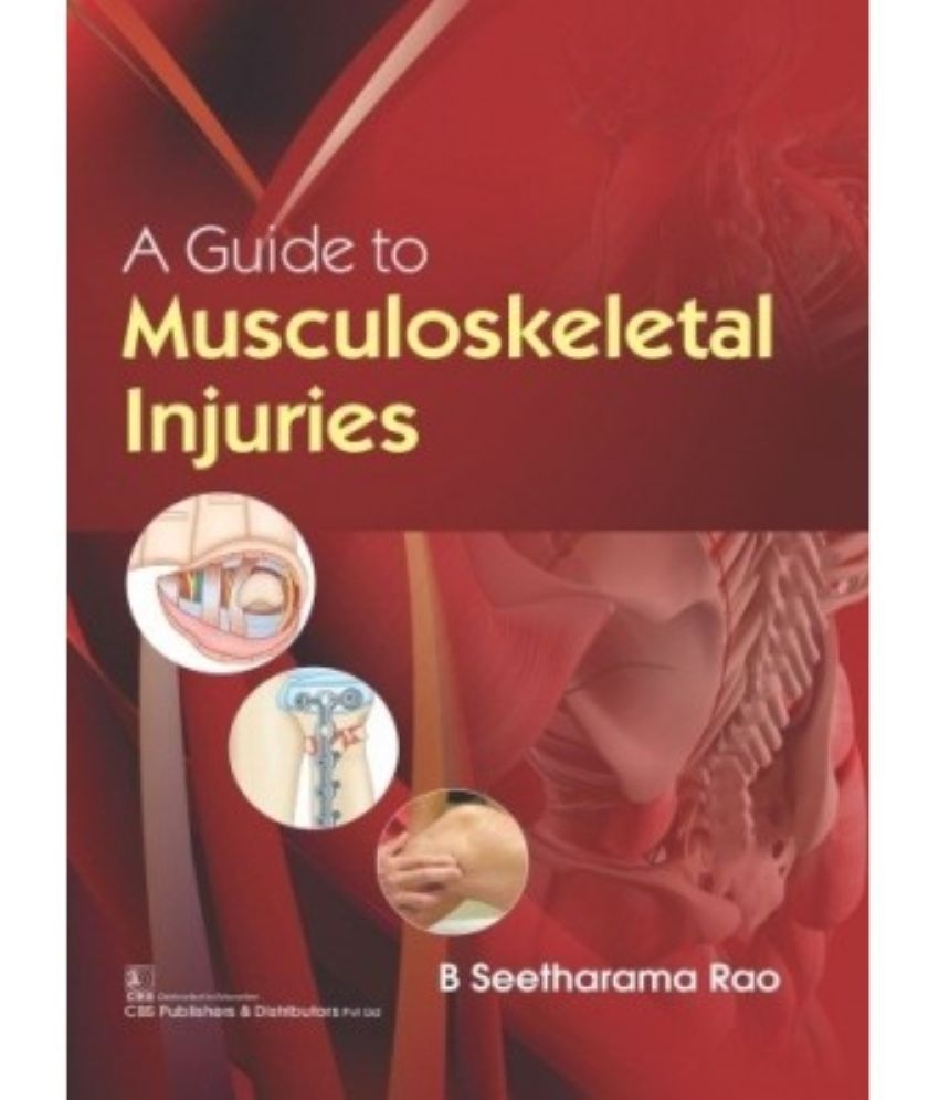     			A Guide to Musculoskeletal Injuries