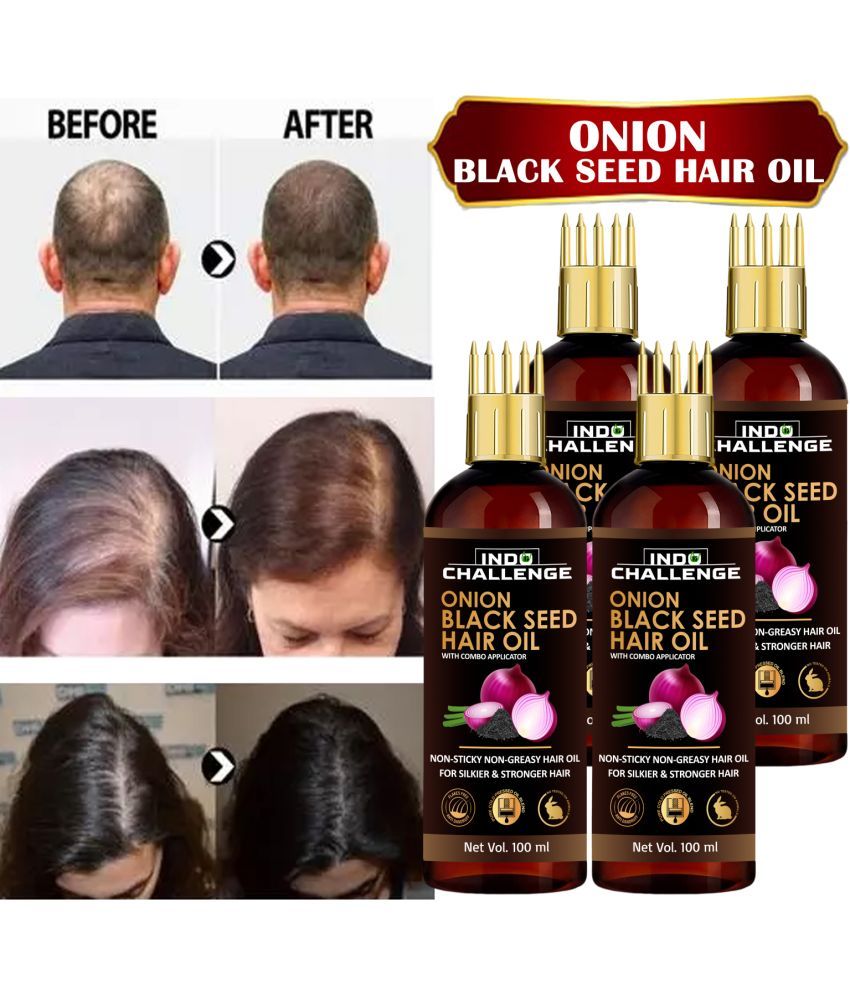     			INDO CHALLEGE Anti Dandruff Onion Oil 100 ml ( Pack of 4 )