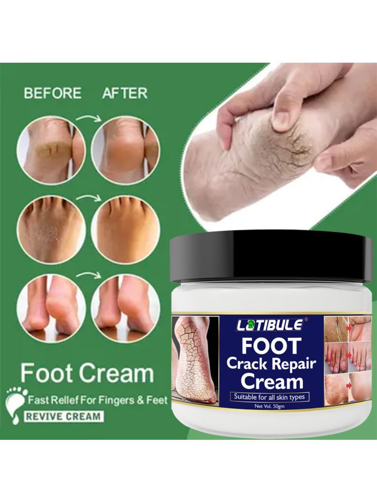     			Latibule Anti Itch Cream for Summer ( 50 g )