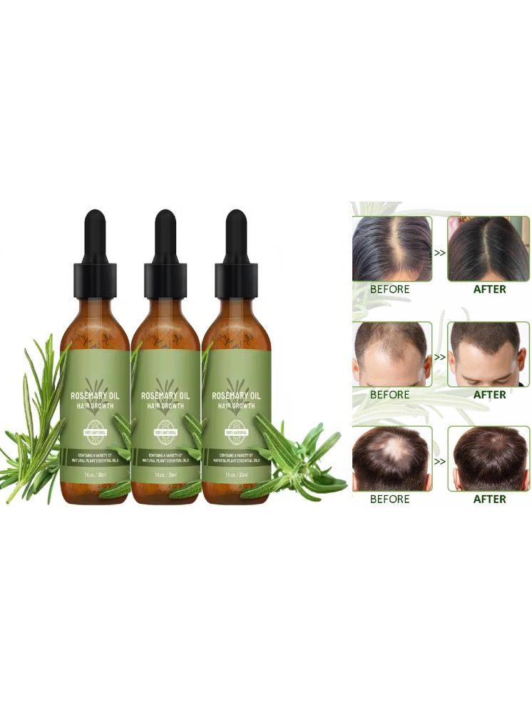     			Oilanic Hair Serum 30 mL Pack of 3